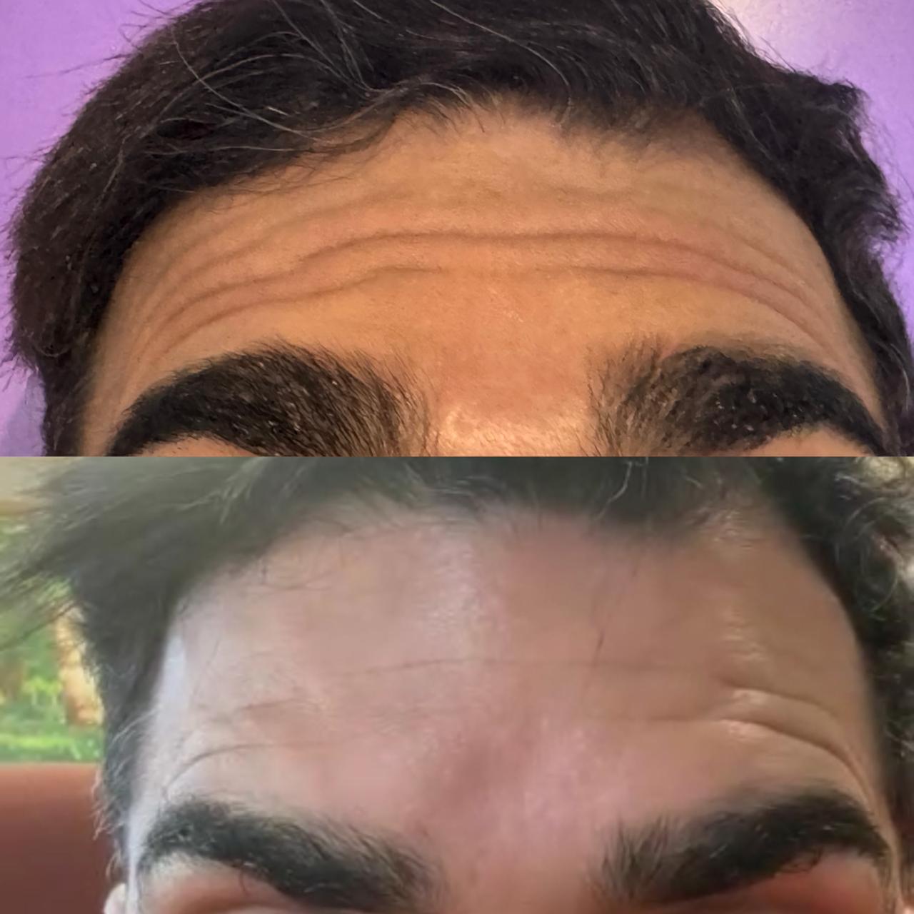 Antes e depois
